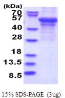 Human PLIN2 / ADFP / Adipophilin Protein (Recombinant)