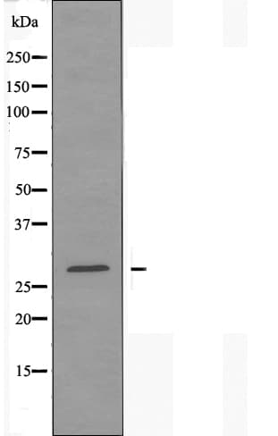 MBL2 / Mannose Binding Protein Antibody
