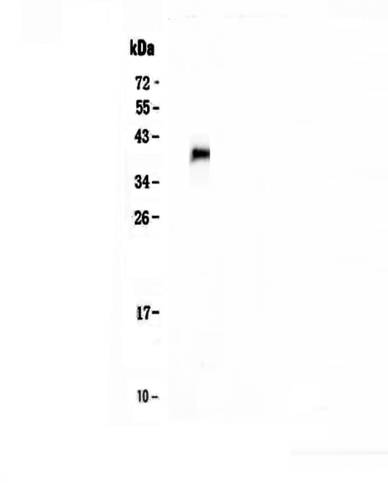 TNFRSF13B / TACI Antibody