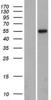 IKZF1 / IKAROS Protein (Over-Expression Lysate Myc-DDK (Flag))