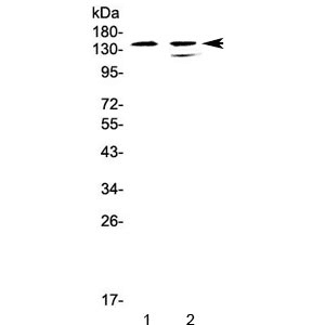 INPP5D / SHIP1 / SHIP Antibody