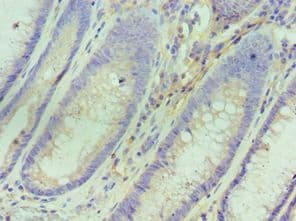 Polyclonal Rabbit anti-Human IL10RA Antibody (aa22-230, IHC, WB)