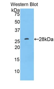 ADAM9 Antibody (aa440-680)