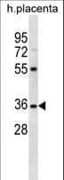 Polyclonal Rabbit anti-Human OR5AN1 Antibody (aa280-309, WB)