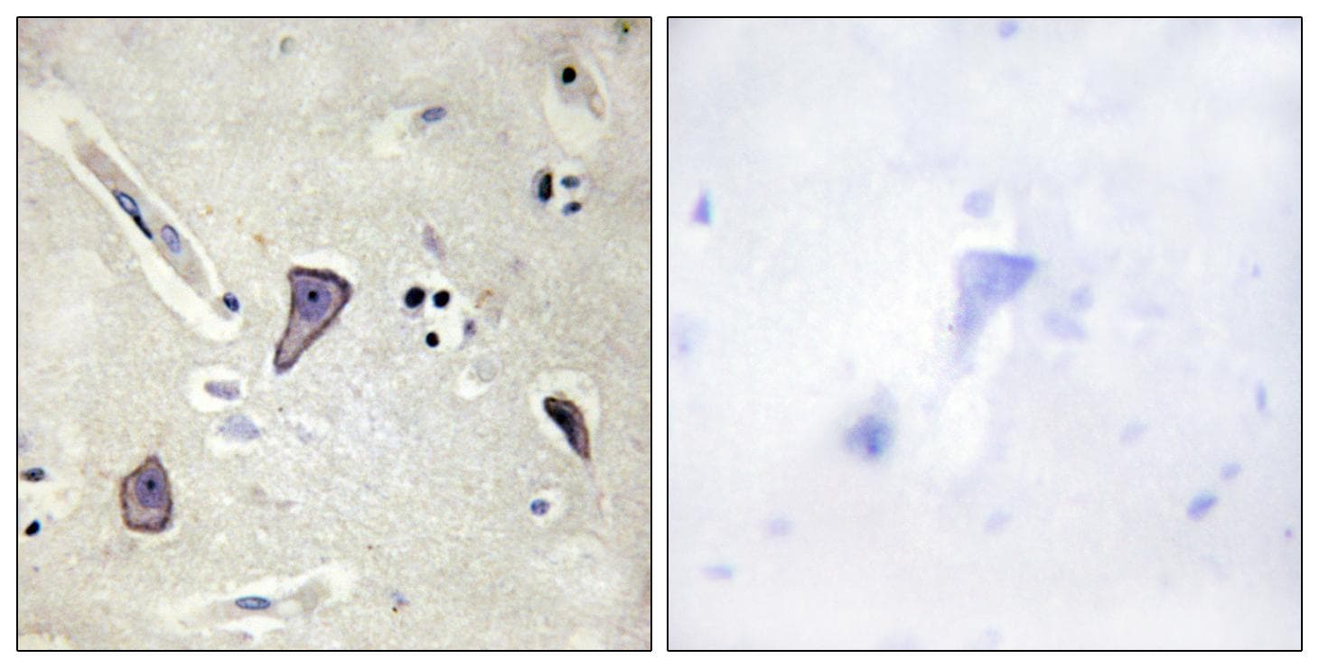 Polyclonal Rabbit anti-Human KCNJ11 / Kir6.2 Antibody (p224, IHC, IF, WB)