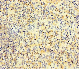 Polyclonal Rabbit anti-Human PLAC8 Antibody (IHC, IF)