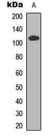 Polyclonal Rabbit anti-Human CDCA2 Antibody (Internal, IHC, WB)