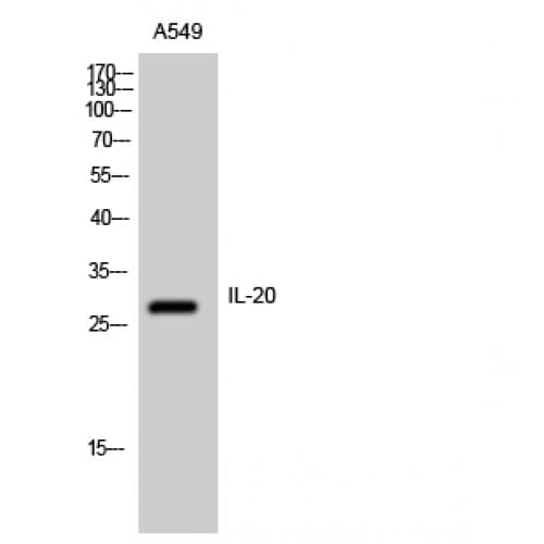 IL20 Antibody (Internal)