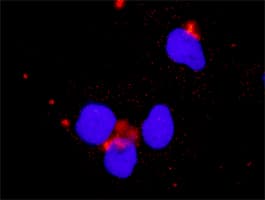 PIK3CB / PI3K Beta Antibody (clone 4H2)