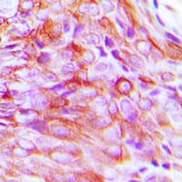 Polyclonal Rabbit anti-Human SLC5A3 Antibody (Internal, IHC, WB)