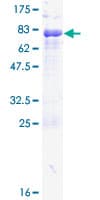 Human PAX6 Protein (Recombinant GST)