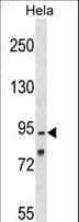 OSBPL1A / ORP1 Antibody (aa736-763)
