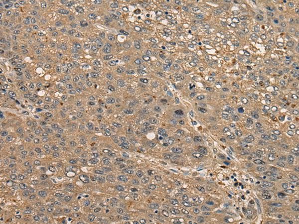 CCDC85C Antibody