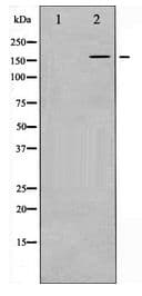 Polyclonal Rabbit anti-Human EGFR Antibody (IHC, IF, WB)