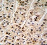 Polyclonal Rabbit anti-Human PCNA Antibody (aa231-261, IHC, IF, WB)
