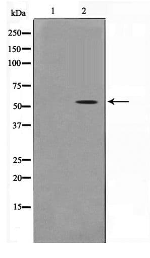 TSAP6 / STEAP3 Antibody