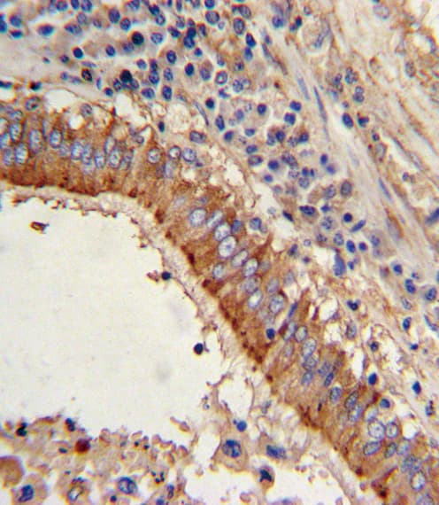 MVP / VAULT1 Antibody (aa863-893)