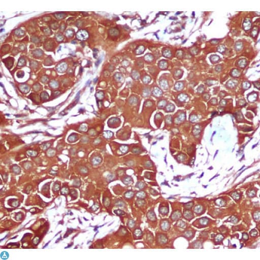 Monoclonal Mouse anti-Human PRKAB1 / AMPK Beta 1 Antibody (WB)