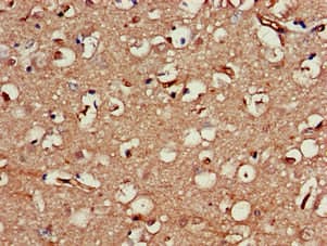 Polyclonal Rabbit anti-Human Neuroserpin Antibody (IHC)