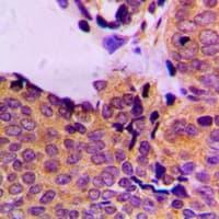 Polyclonal Rabbit anti-Human PDPK1 / PDK1 Antibody (phospho-Ser241, IHC, WB)