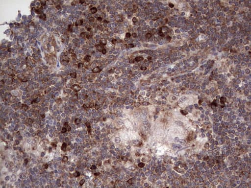LGALS3 / Galectin 3 Antibody (clone OTI6E1)