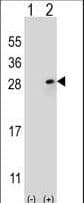 Polyclonal Rabbit anti-Human FGF9 Antibody (aa31-58, WB)