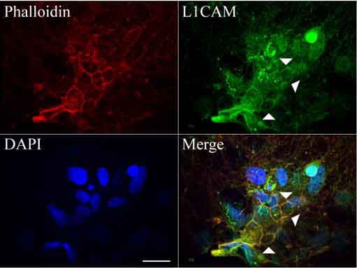 Monoclonal Mouse anti-Human L1CAM Antibody (clone UMAB48, Carrier-free, IHC, IF, WB)