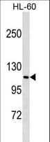 Polyclonal Rabbit anti-Human MPHOSPH9 Antibody (aa248-275, WB)