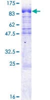 Human CPSF6 Protein (Recombinant GST)
