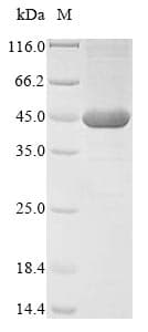 Neisseria meningitidis nadA Protein (Recombinant 6His, N-terminus)