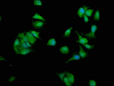NME1 / NM23 Antibody
