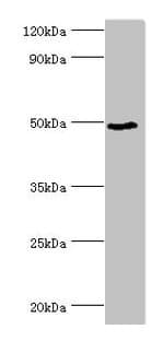 Polyclonal Rabbit anti-Human BANP Antibody (aa1-260, IHC, WB)