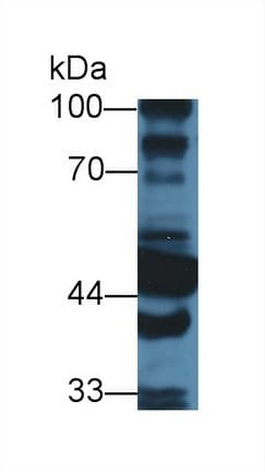 ALDH1A1 / ALDH1 Antibody (APC)