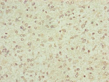 FBXO6 Antibody