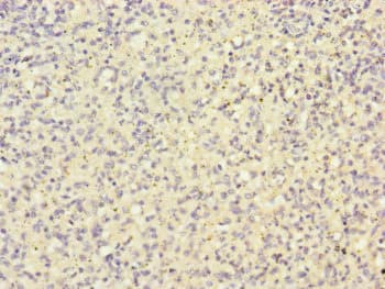HK3 / Hexokinase 3 Antibody