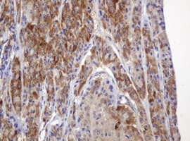 TBC1D13 Antibody (clone OTI2C5, Carrier-free)