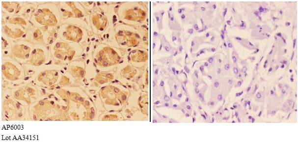 Polyclonal Rabbit anti-Human PTPRO Antibody (IHC, WB)