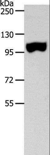 Polyclonal Rabbit anti-Human SPAG1 / TPIS Antibody (IHC, WB)