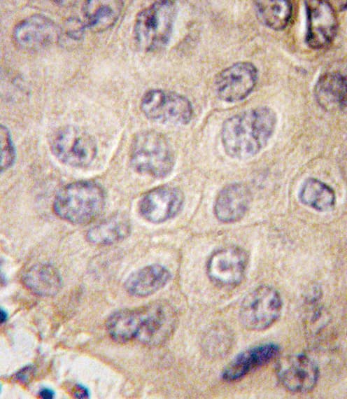 EDA / Ectodysplasin A Antibody (aa47-76)