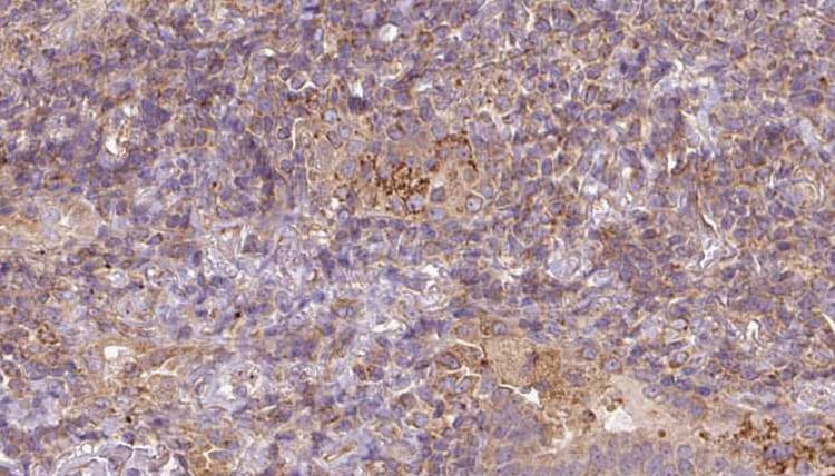 Polyclonal Rabbit anti-Human MAT / MAT1A Antibody (IHC, IF, WB)
