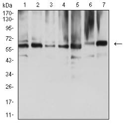 NAA10 / ARD1A Antibody (clone 3G3B9)