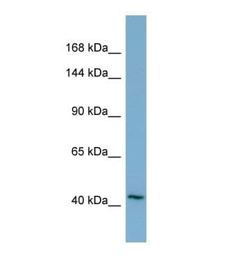 TMEM132A / HSPA5BP1 Antibody (N-Terminus)