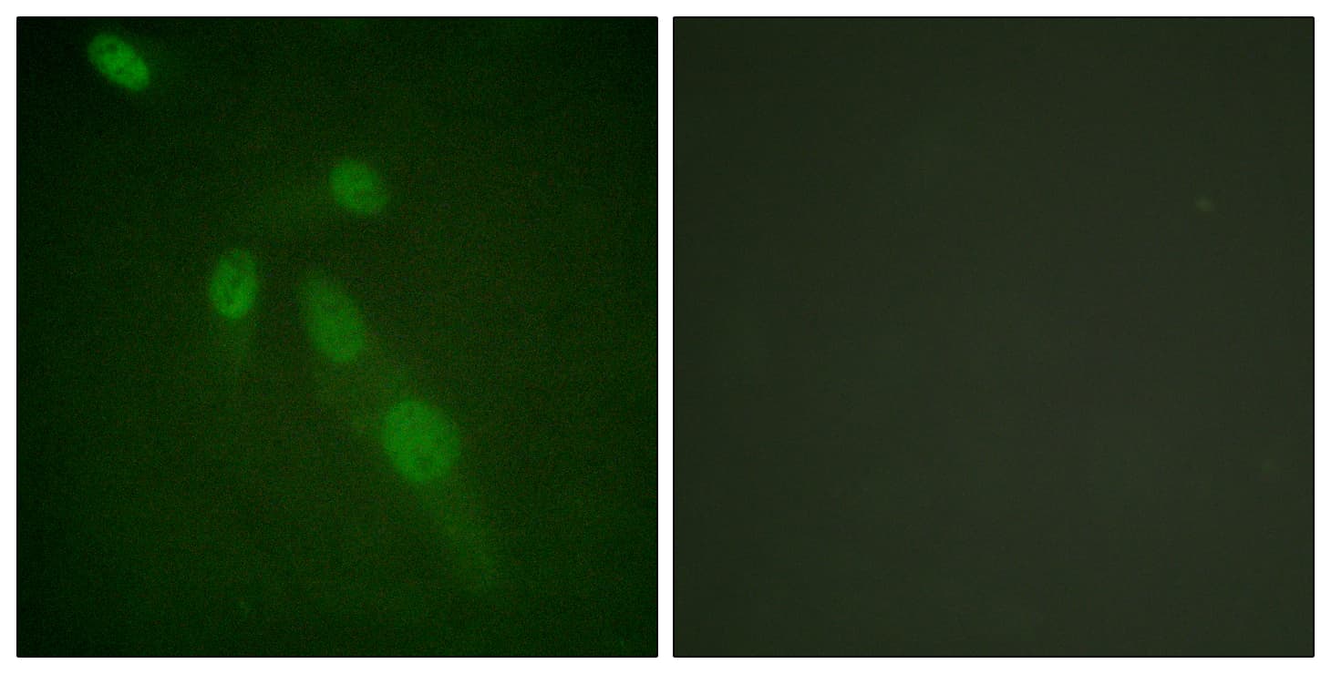 Acetyl-Lysine Antibody