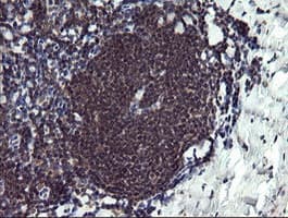 PPIL3 Antibody (clone OTI2E7, Carrier-free)