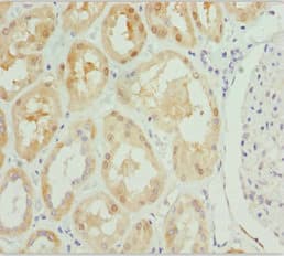 PSPH Antibody