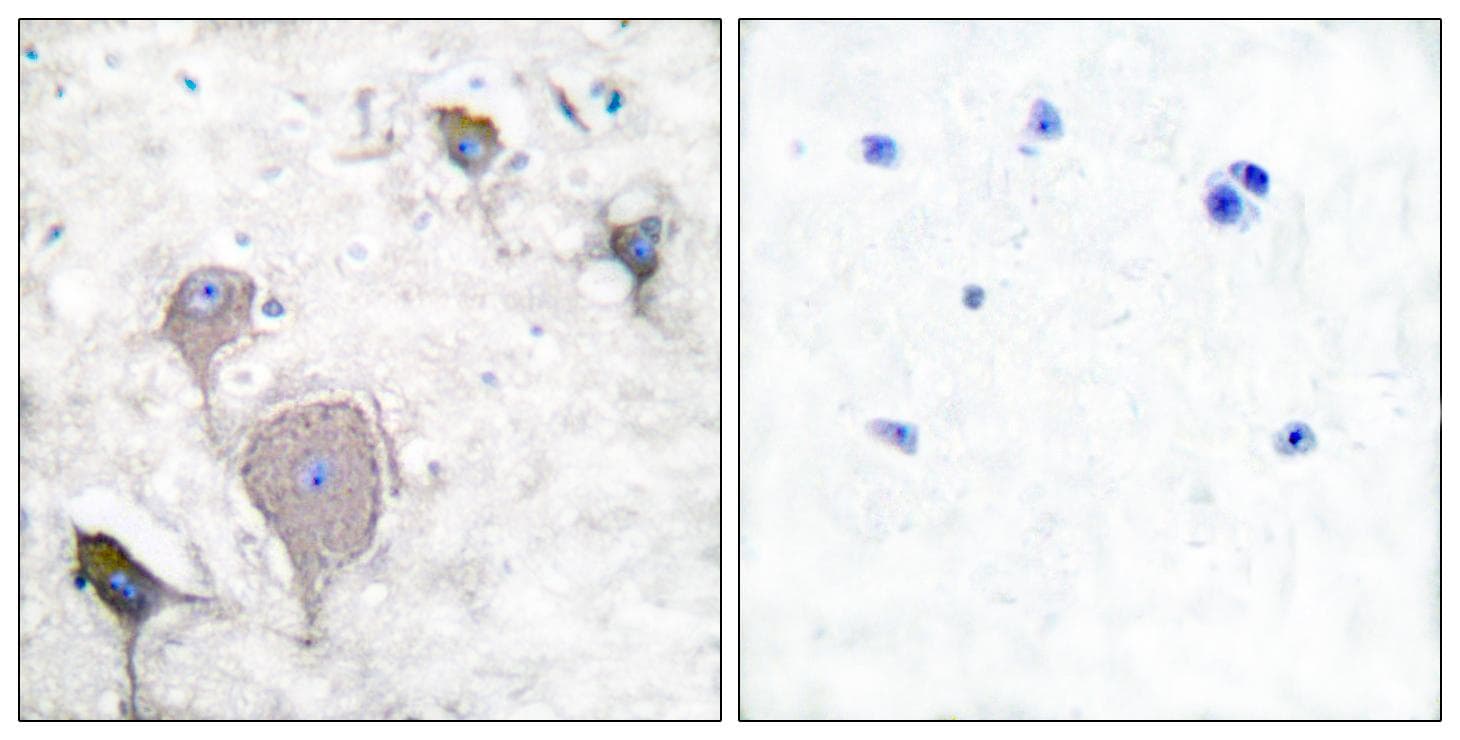 Peripherin Antibody (aa455-470)