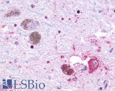 PathPlus™ GPR27 Antibody (C-Terminus)