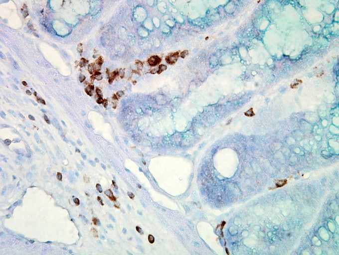 Monoclonal Mouse anti-Human HSP70 / Heat Shock Protein 70 Antibody (clone C92F3A-5, IHC, WB)