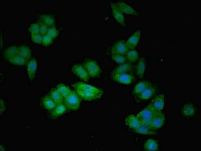 AGT / Angiotensinogen Antibody (aa44-427)