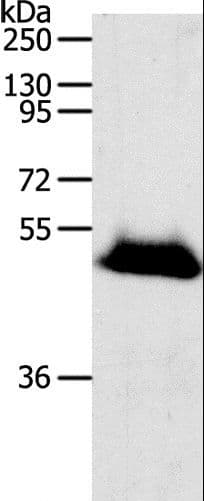 Polyclonal Rabbit anti-Human RBMS3 Antibody (IHC, WB)